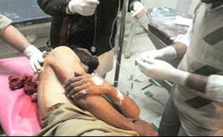 One more victim of Peshawar blast dies, death toll rises to 12