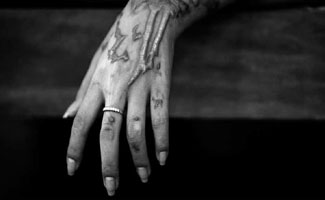 Muzaffargarh: Acid attack on woman, sustains burnt injuries