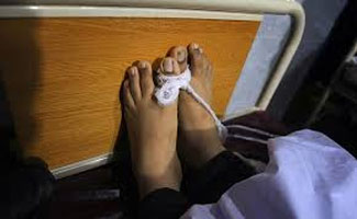 Student of APS attack succumbs to injuries