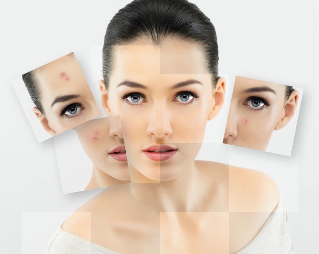 These home remedies will help treat your oily skin naturally