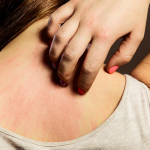 Do not ignore these seven early symptoms of cancer
