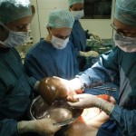 Surgeons from Pakistan, Iran perform successful Liver Transplantations at SIUT