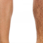 Easy home made remedies to remove unwanted hair on legs