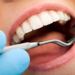 Tooth decay can be reversed without drilling, filling