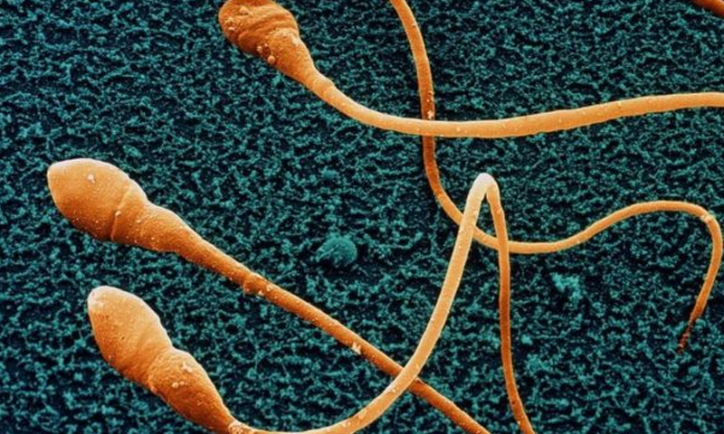 Humans could become extinct if sperm counts in men continue to fall