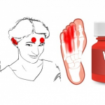 These signs can tell about vitamin deficiency in your body