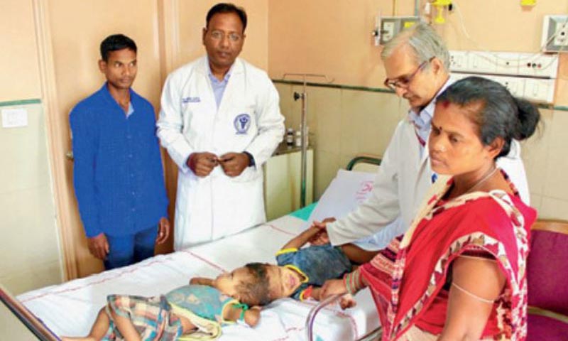 Indian doctors separate twins joined at the head
