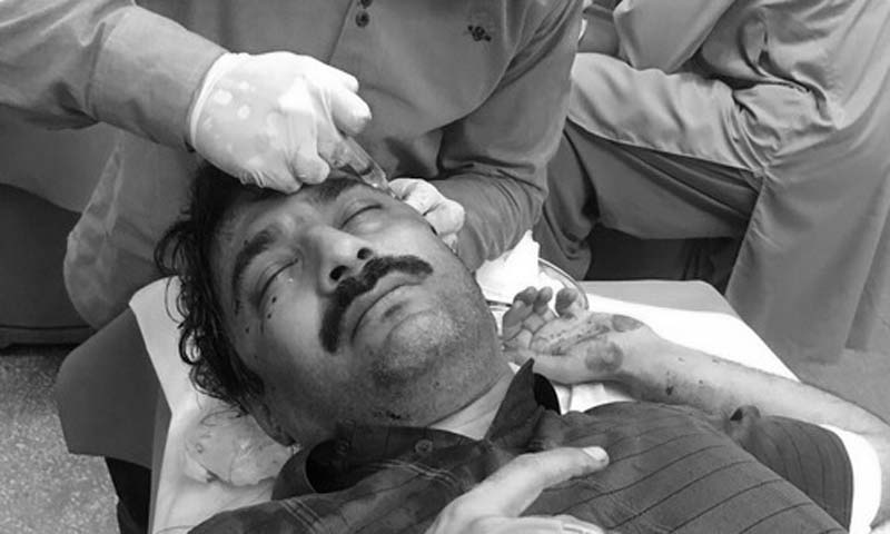 Outspoken journalist attacked in Islamabad