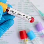 Pakistan has 2nd largest burden of hepatitis C in the world