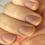 Find out what your nails tell about your health?