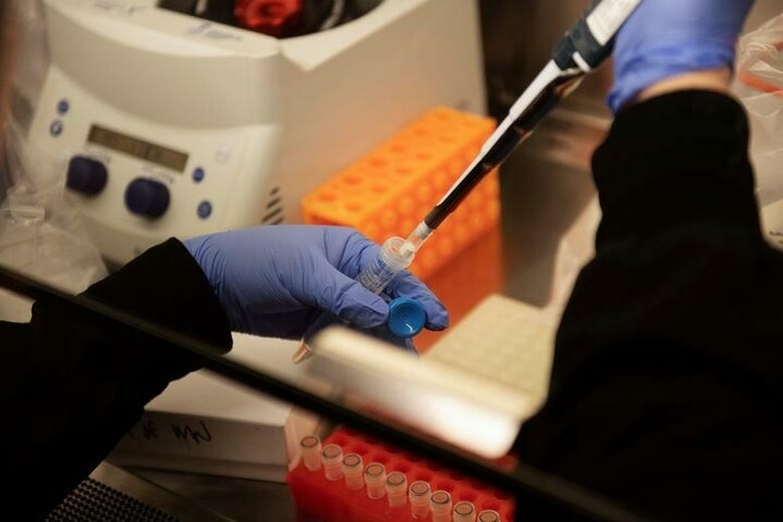 Covid: Sindh reduces PCR testing fee by Rs2,000