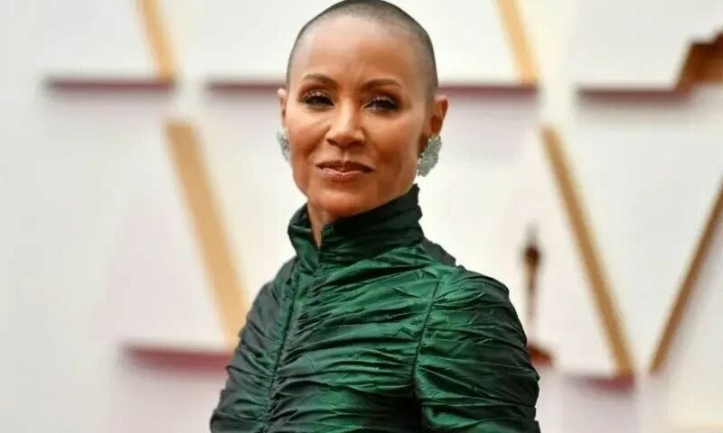 Hair loss: Women speak of the pain of going bald