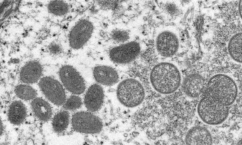 Pakistan declares high alert for suspected monkeypox cases