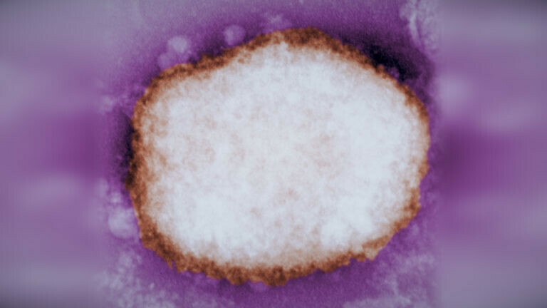 WHO: 780 cases of monkeypox in 27 countries