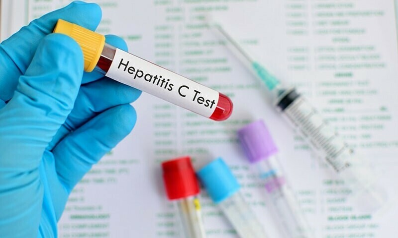 Hepatitis more prevalent in men than women, top moot told