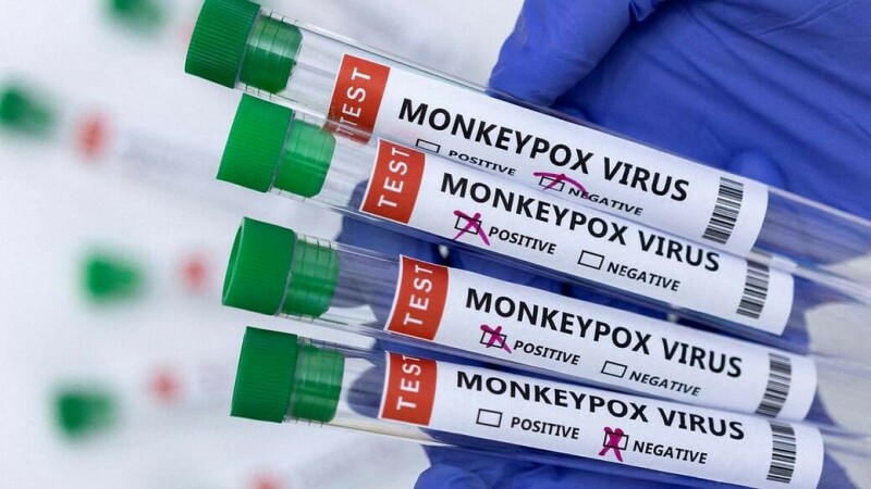 WHO turns to public for monkeypox name change