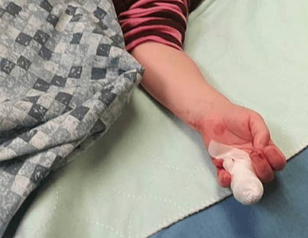 Drug addict chops off fingers of six-year-old niece