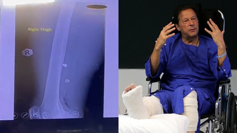 Imran Khan rapidly recovering from wounds, could be discharged within 48 hours