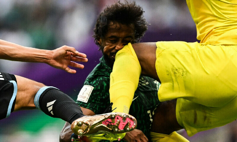 Saudi&rsquo;s Al-Shahrani to undergo surgery after World Cup collision