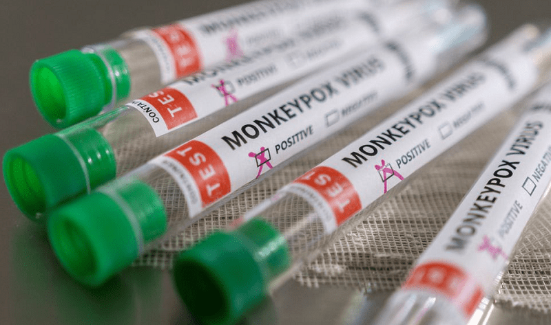 Pakistan confirms first monkeypox case reported in Karachi