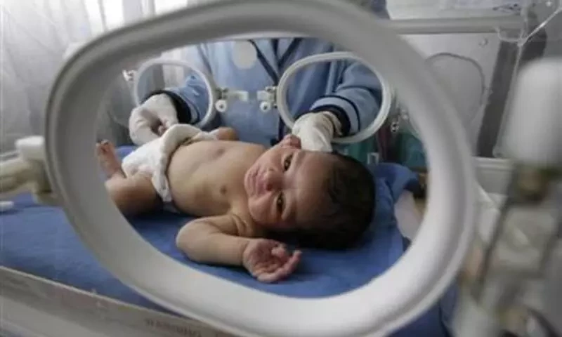 Newborn suffers burns at Islamabad&rsquo;s private hospital