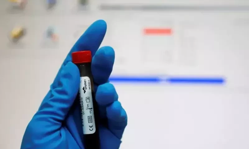 Five Pakistani athletes test positive for banned substance