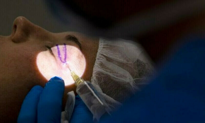 Main accused in eye injection case arrested from Faisalabad