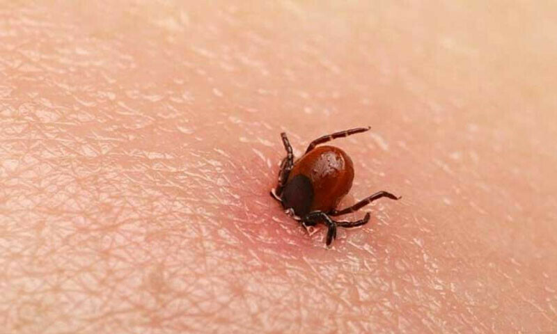 Ten doctors under treatment for Congo virus in Karachi: Balochistan minister