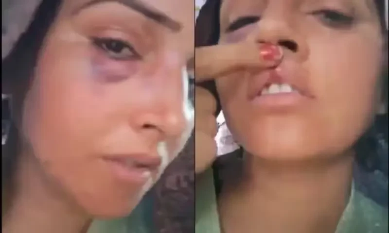 Seema Haider&rsquo;s video with swollen eyes and lip injury goes viral