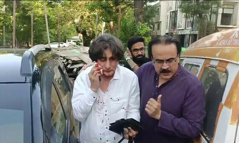 PTI&rsquo;s Raoof Hassan injured in attack