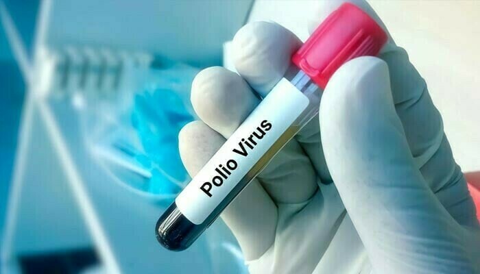 Polio samples detected in three more cities including Islamabad