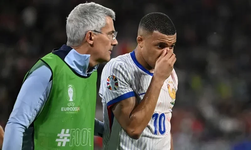 Mbappe breaks nose in France Euro 2024 win