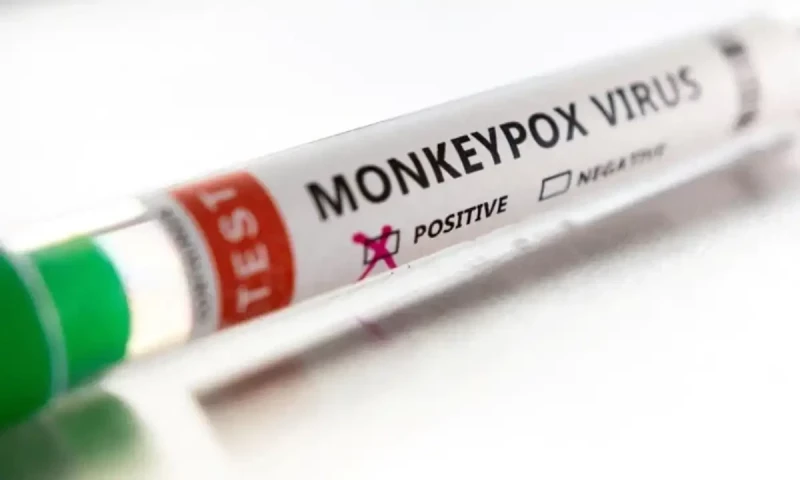 Third case of mpox confirmed in Pakistan