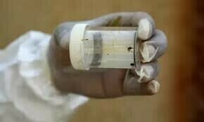Another two cases of Congo virus emerge in Quetta