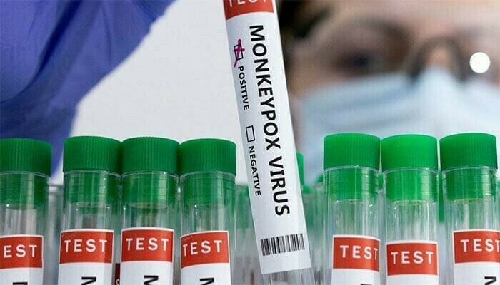 Three Mpox cases detected in Karachi in a single day