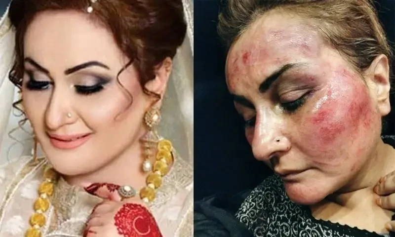 Former theatre actress Nargis allegedly beaten by hsuband