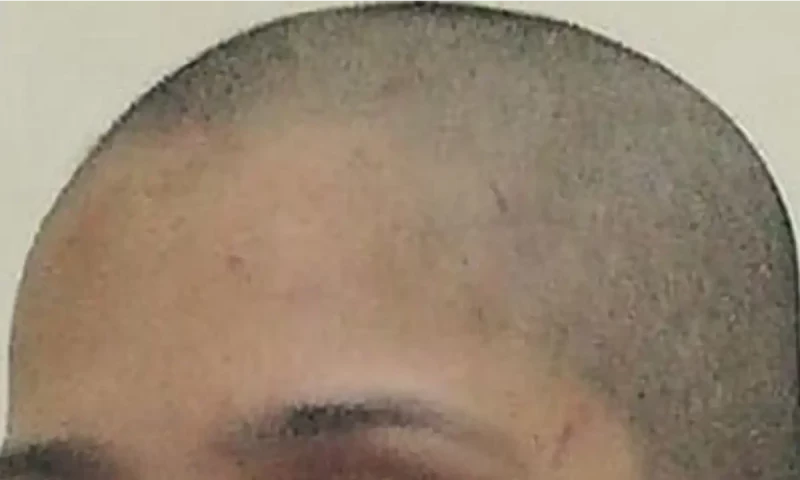 Karachi woman&rsquo;s head shaved after trying to marry by choice