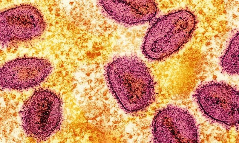 Pakistan reports first Mpox case of 2025