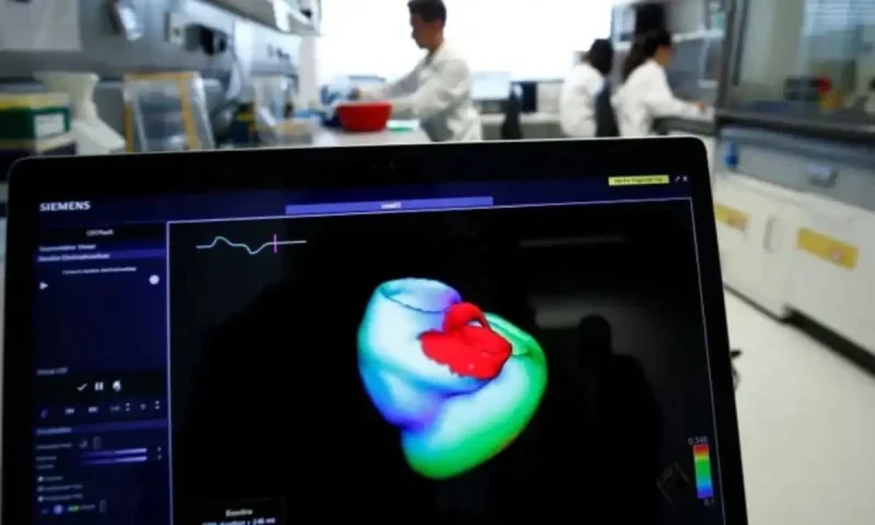 Why heart attacks are increasing in young adults?
