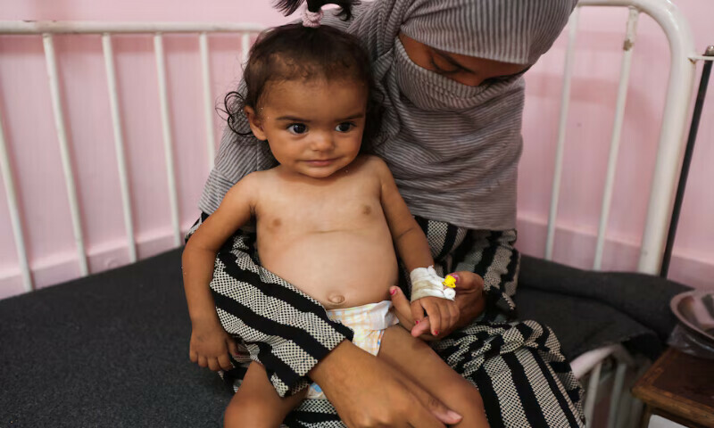 A Palestinian woman, Zina Radwan, holds her 10-month-old daughter, Maria, who is malnourished at Nasser Hospital in Khan Younis, southern Gaza Strip. – Reutrers