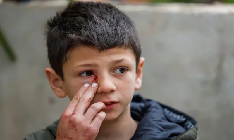 An injured Palestinian child, Mustafa, gestures during a funeral of his family who were killed in an Israeli raid in Tammoun town near Tubas in the Israeli-occupied West Bank on Sunday. &ndash; Reuters
