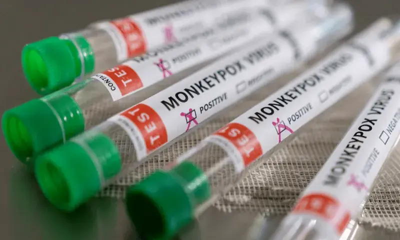 Mpox cases rise in Sindh, authorities urge precautions