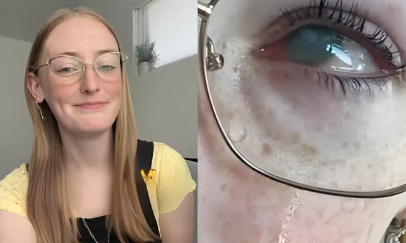 کانٹیکٹ لینس پہن کر نہانے والی لڑکی بینائی کھو بیٹھی