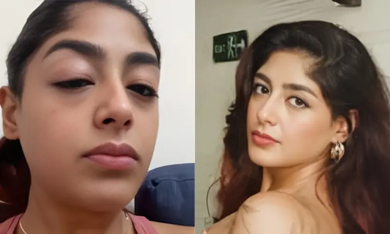 ریئلٹی شو کی سابقہ امیدوار پر مبینہ حملہ، چہرہ زخمی اور دانت ٹوٹنے کا دعویٰ