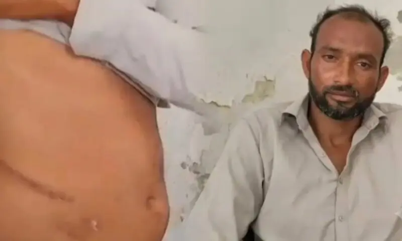 پتوکی: دوست نے دوست کا گردہ نکال کر فروخت کردیا