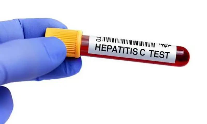 England moves closer to eliminating hepatitis C ahead of 2030 target