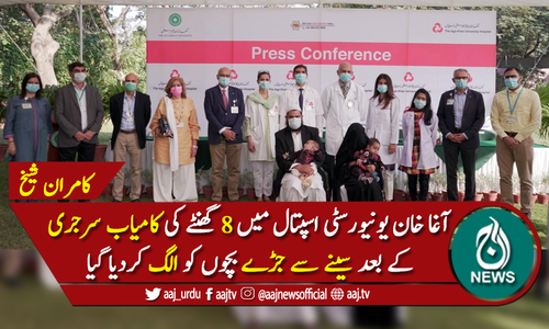 9 ماہ کے سینے سے جڑے بچوں کو ایک دوسرے سے الگ کردیا گیا