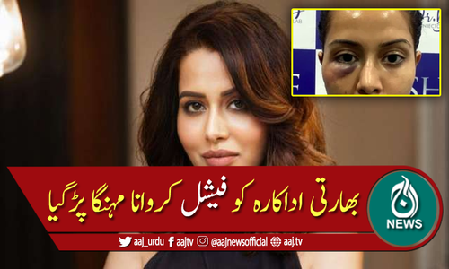 نئے فیشل سے بھارتی اداکارہ کا چہرہ بگڑ گیا