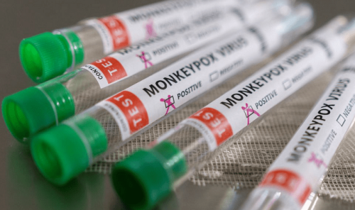 Pakistan confirms first monkeypox case reported in Karachi