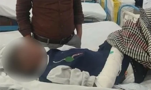 Maid torture case: Rizwana to have plastic surgery